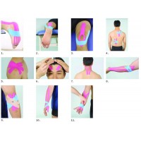 KINESIOTAPING